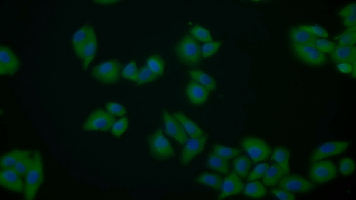 Polyclonal Antibody to Pyruvate kinase isozymes M2 (PKM2)