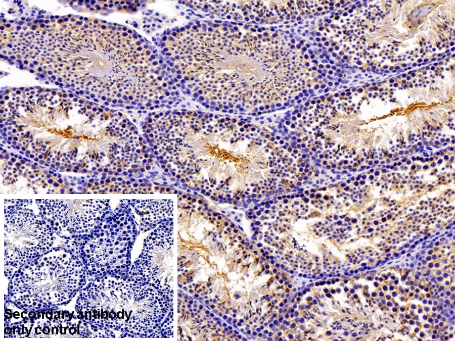 Polyclonal Antibody to Pyruvate kinase isozymes M2 (PKM2)