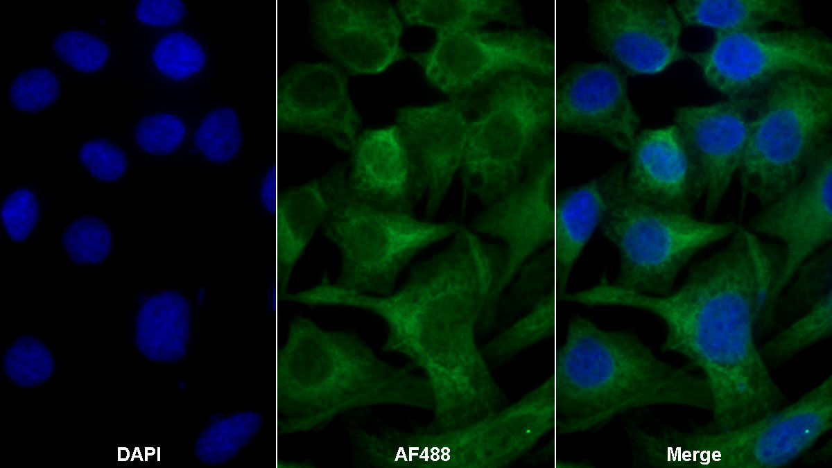 Polyclonal Antibody to Pyruvate kinase isozymes M2 (PKM2)