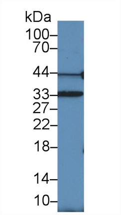 Polyclonal Antibody to Proliferating Cell Nuclear Antigen (PCNA)