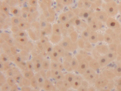 Polyclonal Antibody to Proliferating Cell Nuclear Antigen (PCNA)