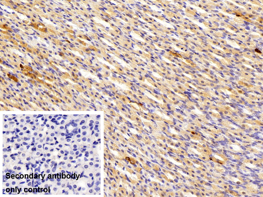 Polyclonal Antibody to Somatostatin (SST)