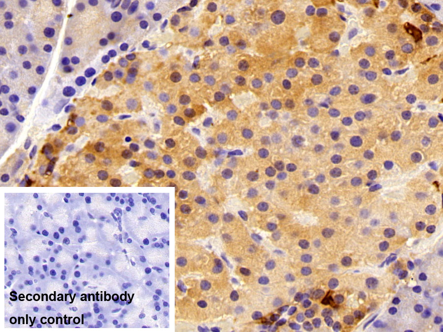 Polyclonal Antibody to Somatostatin (SST)