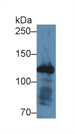 Polyclonal Antibody to Fibrillin 1 (FBN1)