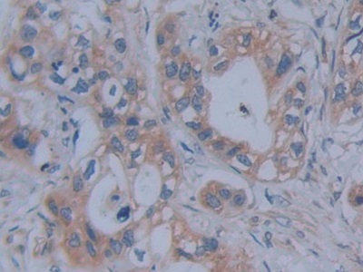 Polyclonal Antibody to Fibrillin 1 (FBN1)