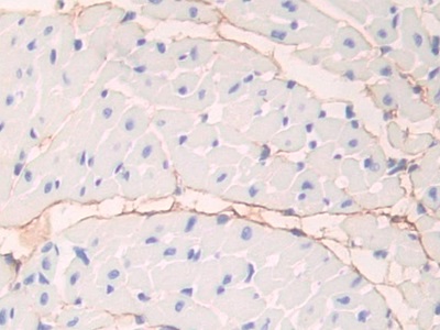 Polyclonal Antibody to Fibrillin 1 (FBN1)