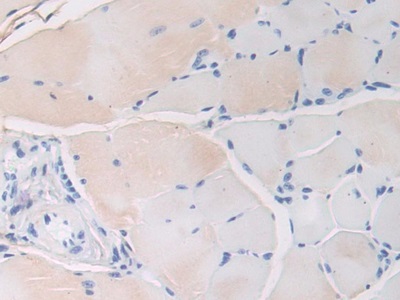 Polyclonal Antibody to Fibrillin 1 (FBN1)