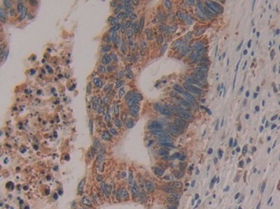 Polyclonal Antibody to Cytochrome C (CYCS)