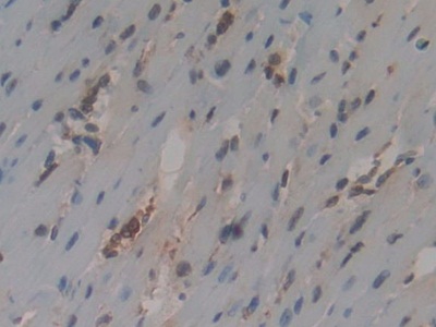 Polyclonal Antibody to Cytochrome C (CYCS)