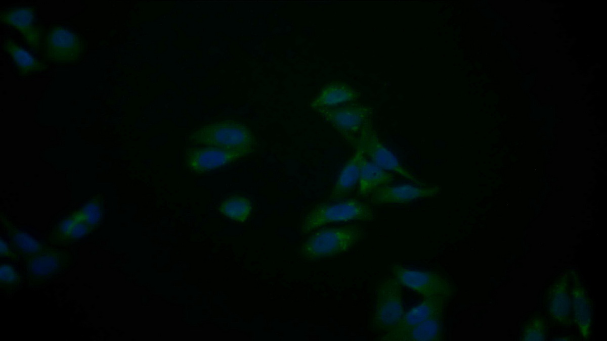 Polyclonal Antibody to Cytochrome C (CYCS)