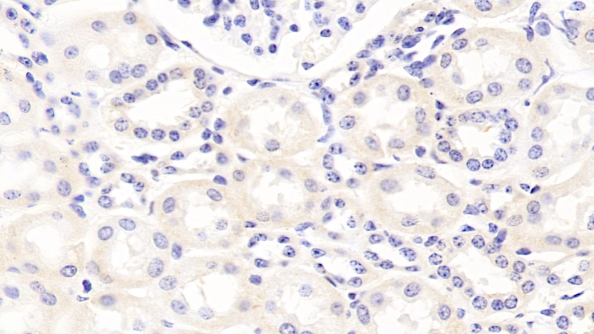 Polyclonal Antibody to Apolipoprotein B100 (APOB100)