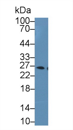 Polyclonal Antibody to Glutathione S Transferase Alpha 1 (GSTa1)