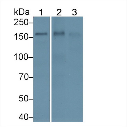 Polyclonal Antibody to Thrombospondin 1 (THBS1)