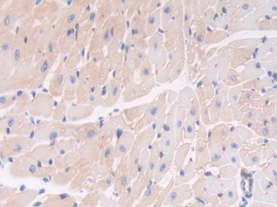 Polyclonal Antibody to Thrombospondin 1 (THBS1)