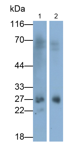 Polyclonal Antibody to Glutathione S Transferase Theta 2 (GSTt2)