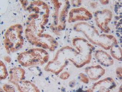 Polyclonal Antibody to Carboxypeptidase B2 (CPB2)