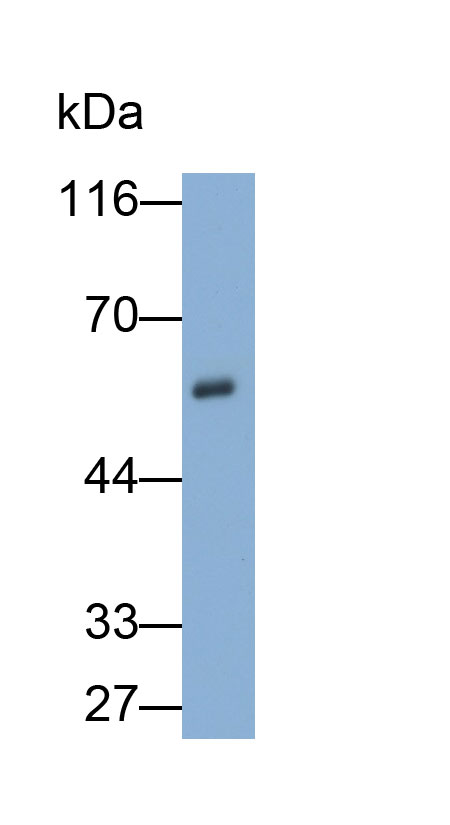 Polyclonal Antibody to Carboxypeptidase B2 (CPB2)