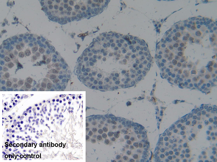 Polyclonal Antibody to Carboxypeptidase B2 (CPB2)