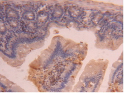 Polyclonal Antibody to Carboxypeptidase B2 (CPB2)