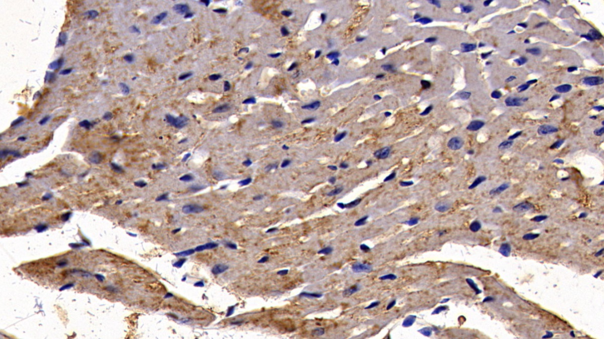 Polyclonal Antibody to Transcription Factor P65 (NFKB3)