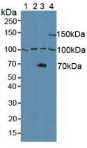 Polyclonal Antibody to A Disintegrin And Metalloprotease 8 (ADAM8)
