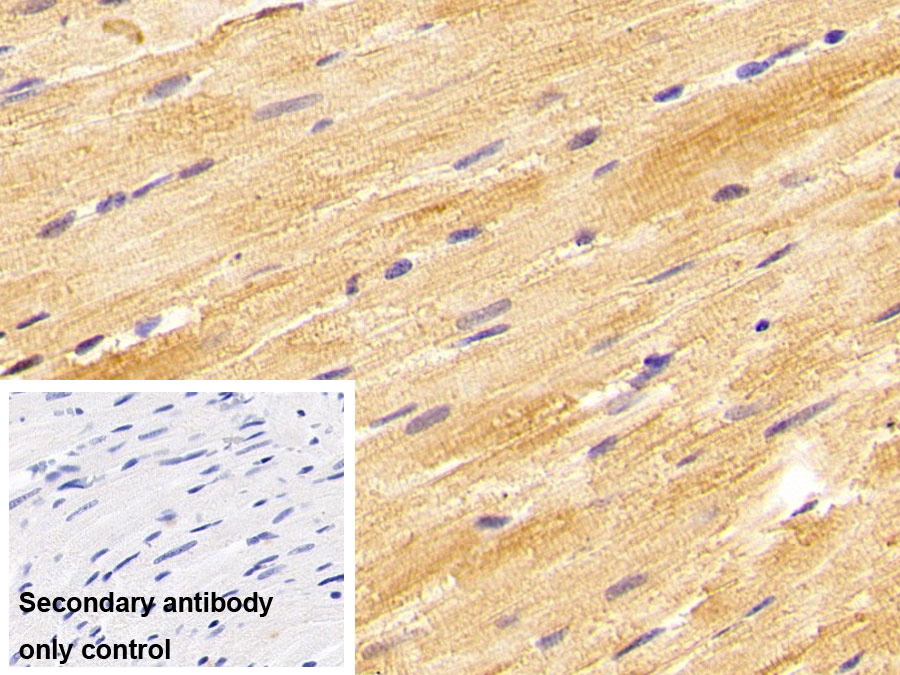 Polyclonal Antibody to Glutathione S Transferase Theta 1 (GSTt1)