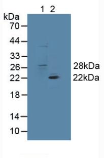 Polyclonal Antibody to Glutathione S Transferase Theta 1 (GSTt1)