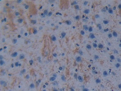 Polyclonal Antibody to Glutathione S Transferase Theta 1 (GSTt1)