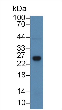 Polyclonal Antibody to Glutathione S Transferase Theta 1 (GSTt1)