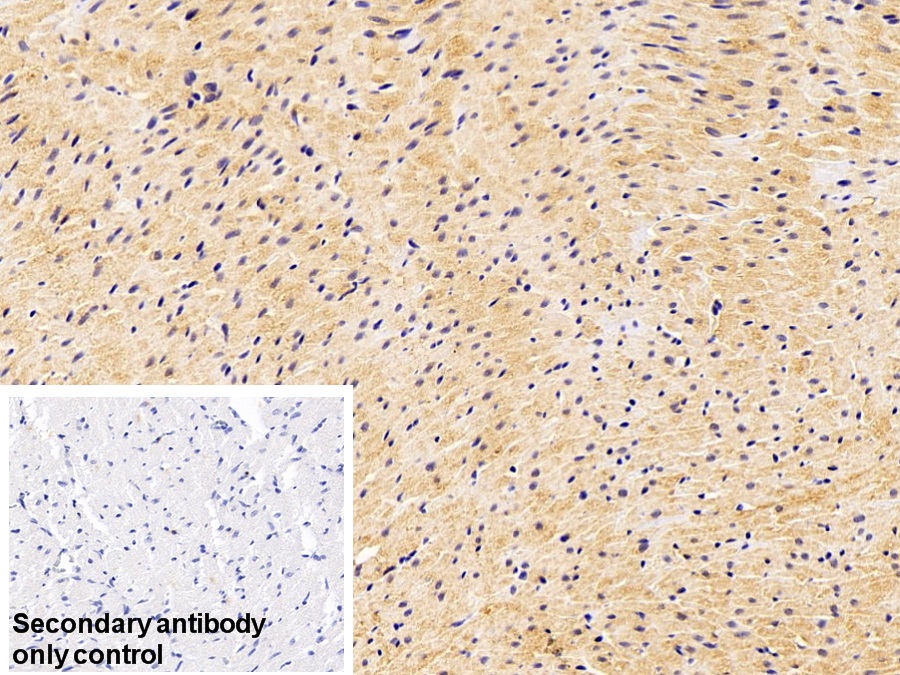 Polyclonal Antibody to Glutathione S Transferase Theta 1 (GSTt1)