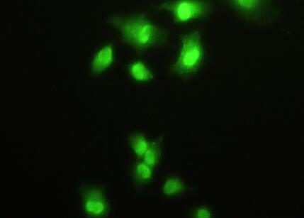 Polyclonal Antibody to Hepatoma Derived Growth Factor (HDGF)