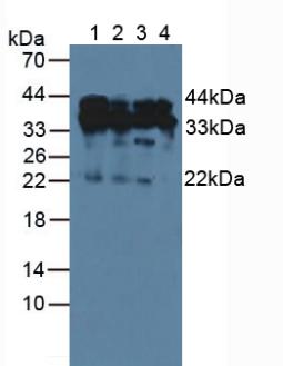 Polyclonal Antibody to Hepatoma Derived Growth Factor (HDGF)