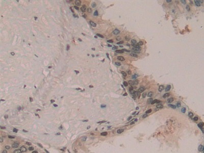 Polyclonal Antibody to Hepatoma Derived Growth Factor (HDGF)