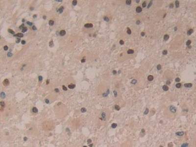 Polyclonal Antibody to Hepatoma Derived Growth Factor (HDGF)