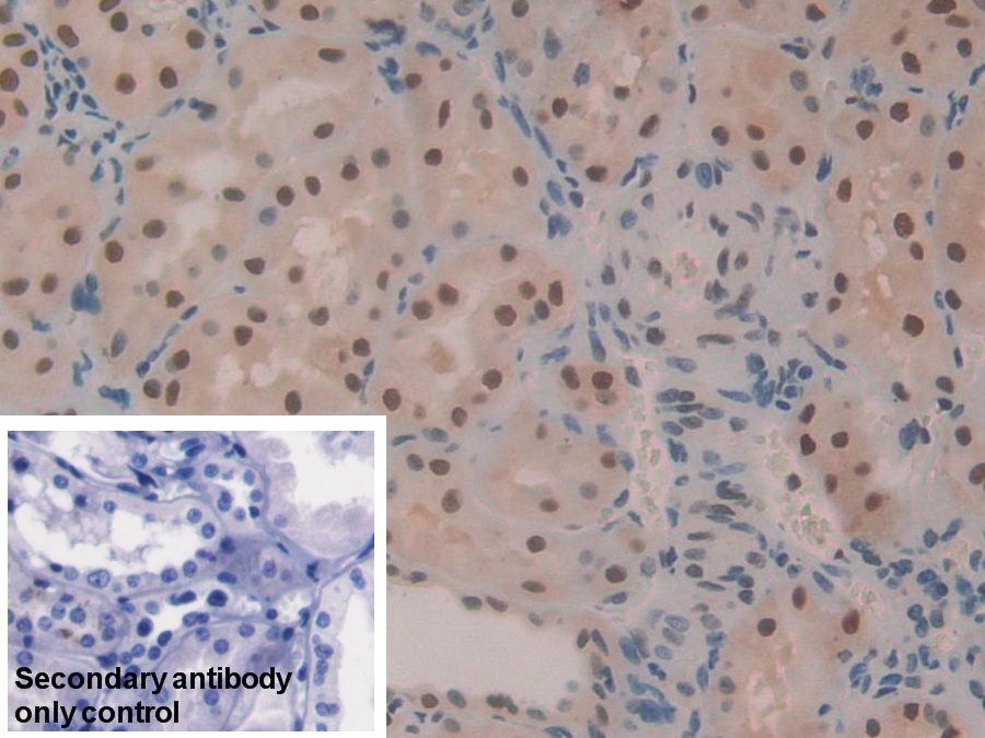 Polyclonal Antibody to Hepatoma Derived Growth Factor (HDGF)