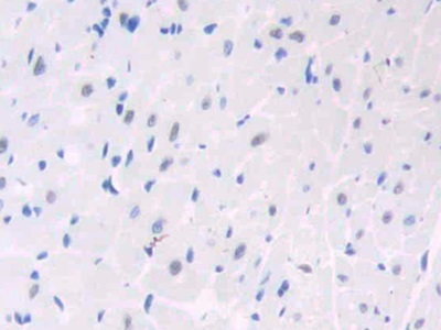 Polyclonal Antibody to Hepatoma Derived Growth Factor (HDGF)