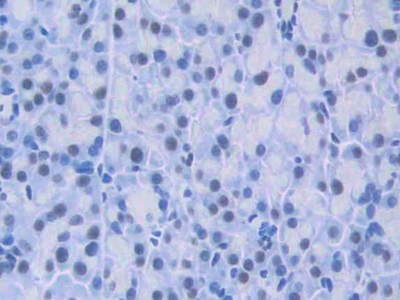 Polyclonal Antibody to Hepatoma Derived Growth Factor (HDGF)