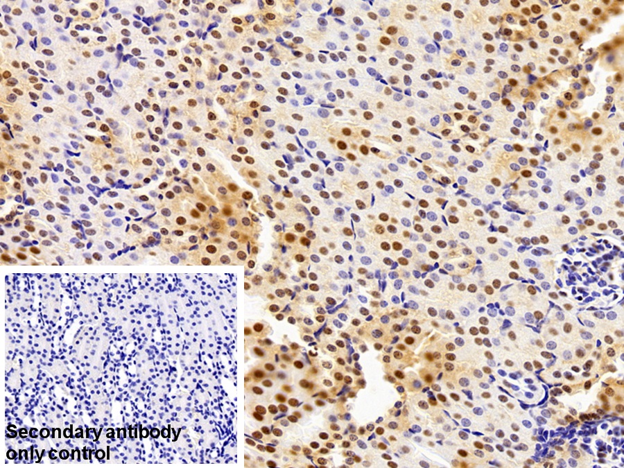 Polyclonal Antibody to Hepatoma Derived Growth Factor (HDGF)