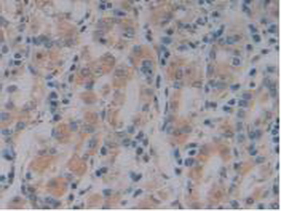 Polyclonal Antibody to Nitric Oxide Synthase Trafficker (NOSTRIN)