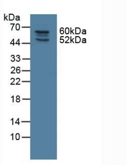 Polyclonal Antibody to Nitric Oxide Synthase Trafficker (NOSTRIN)