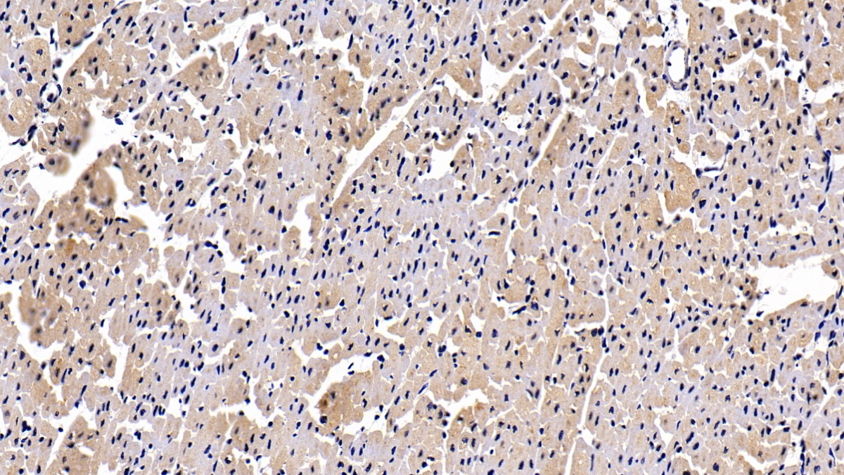 Polyclonal Antibody to Platelet Derived Growth Factor BB (PDGF BB)