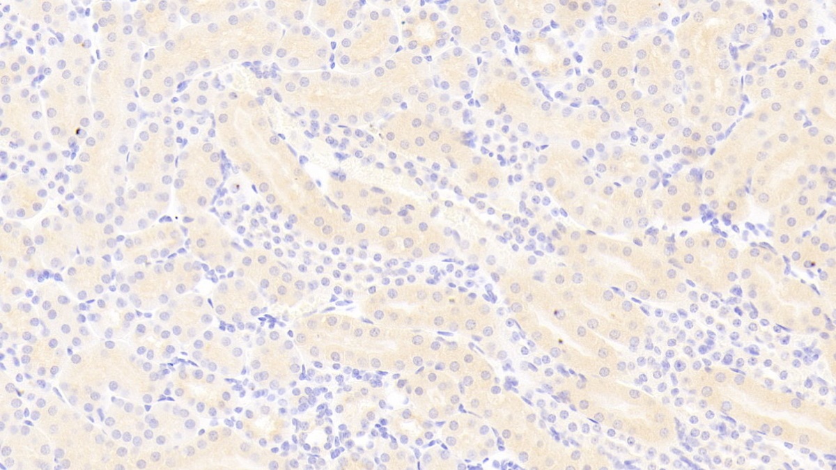 Polyclonal Antibody to Platelet Derived Growth Factor BB (PDGF BB)