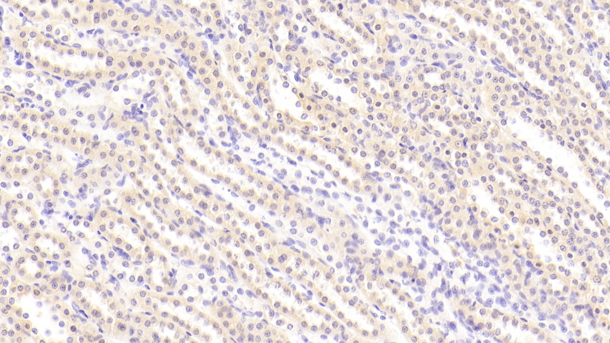 Polyclonal Antibody to Platelet Derived Growth Factor BB (PDGF BB)