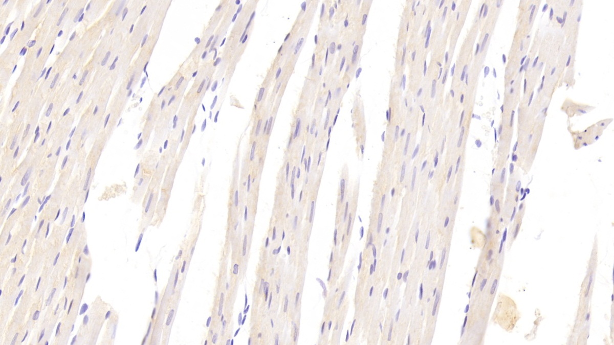 Polyclonal Antibody to Platelet Derived Growth Factor BB (PDGF BB)