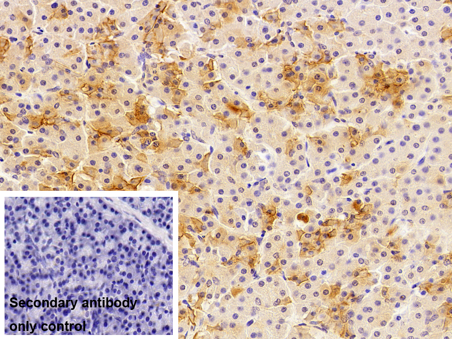 Polyclonal Antibody to Trypsinogen Activation Peptide (TAP)