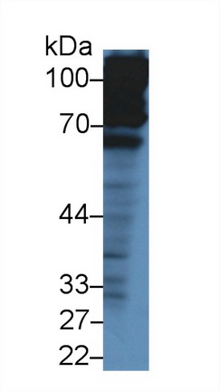 Polyclonal Antibody to Complement Factor H (CFH)