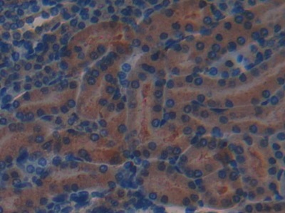 Polyclonal Antibody to Complement Factor H (CFH)