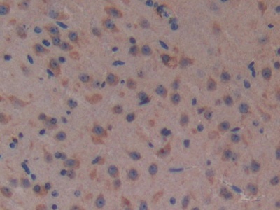 Polyclonal Antibody to Complement Factor H (CFH)