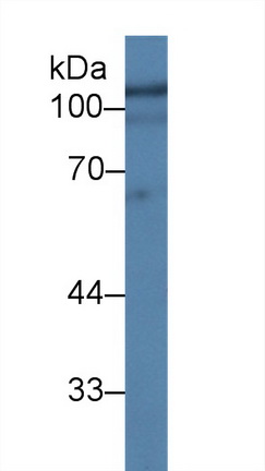 Polyclonal Antibody to Hexosaminidase B Beta (HEXb)