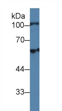 Polyclonal Antibody to Hexosaminidase B Beta (HEXb)